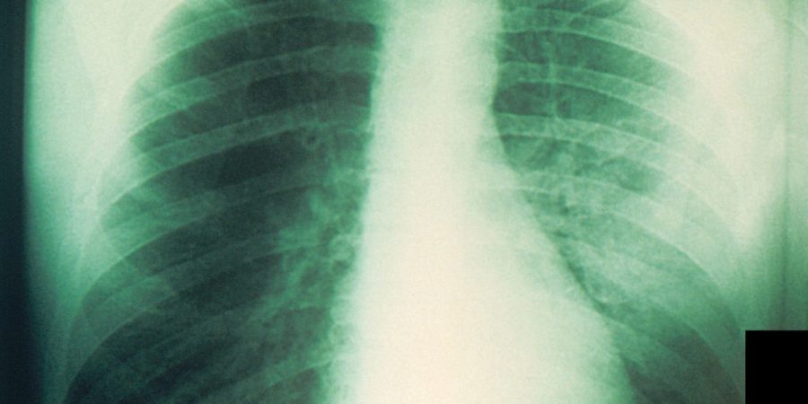 Russian scientist dies in suspected pneumonic plague outbreak in Moscow